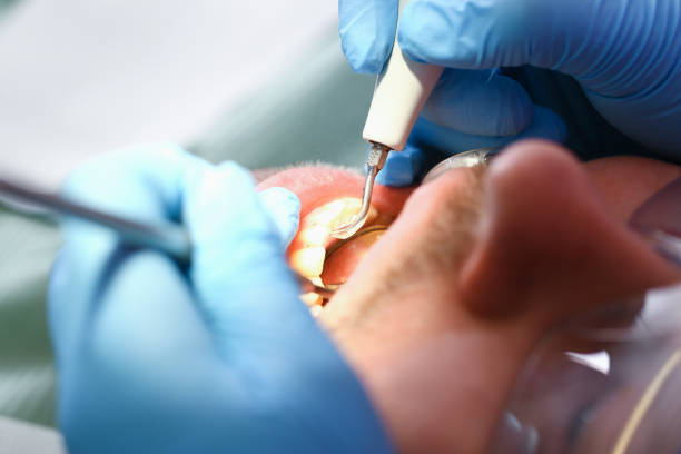 Best Emergency Dentist for Knocked-Out Tooth in Absecon Highlands, NJ